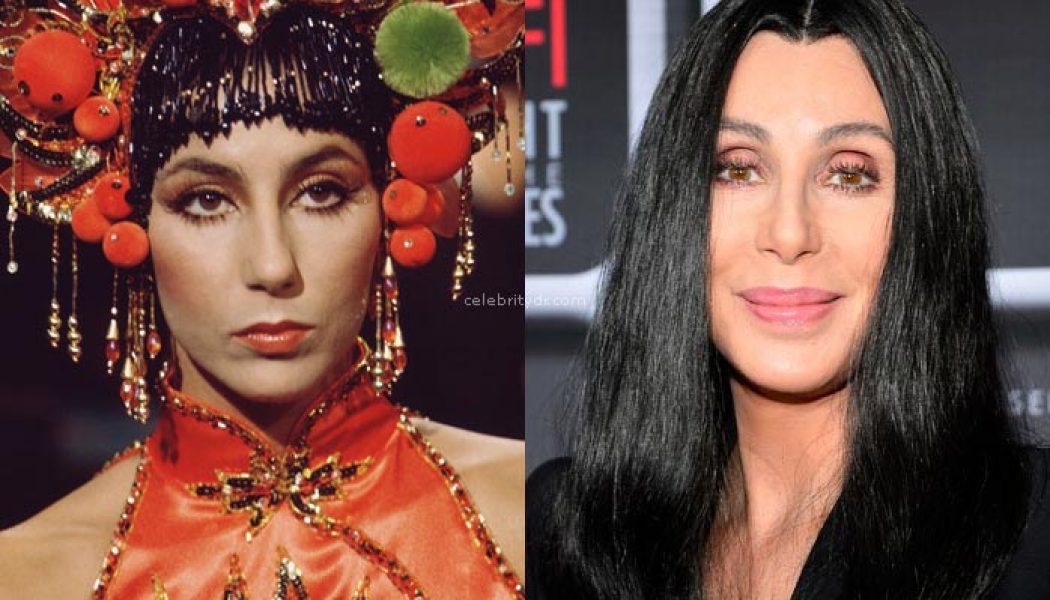 Cher nose job before and after