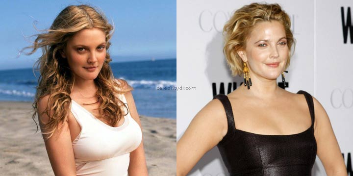 Drew Barrymore breast reduction