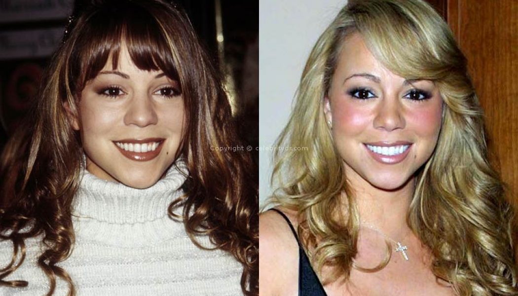 Mariah Carey plastic surgery before and after