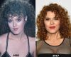 Bernadette Peters plastic surgery before and after