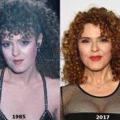 Bernadette Peters plastic surgery before and after