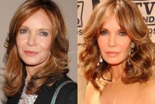 Jaclyn Smith plastic surgery before and after