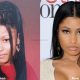 Nicki Minaj plastic surgery before and after